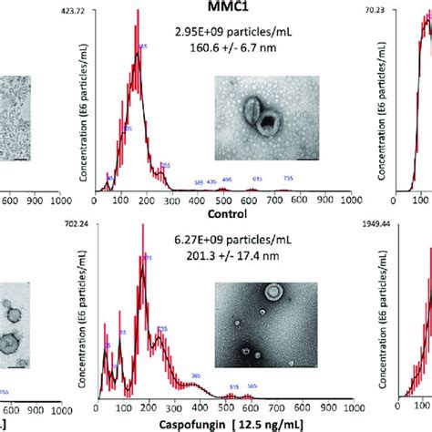 Characterization Of C Auris Evs Extracellular Vesicle Size