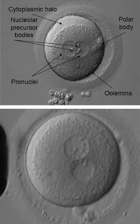 Images Of Human Pronuclear Stage Zygotes Of Group I Top And Group II