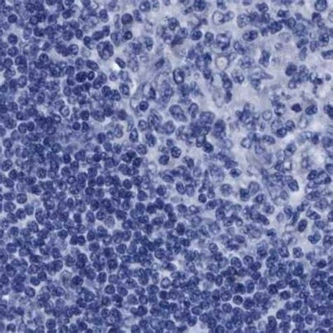 抗 HOOK1 兔抗Anti HOOK1 antibody produced in rabbit