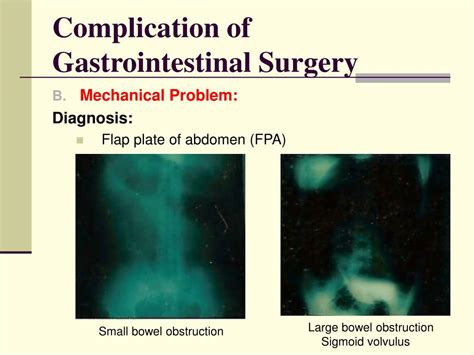 PPT - SURGICAL COMPLICATIONS PowerPoint Presentation, free download - ID:325133