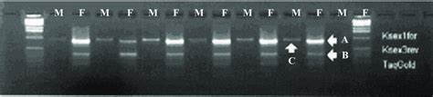 Agarose Electrophoresis Of Pcr Amplification Products Of Known Sex