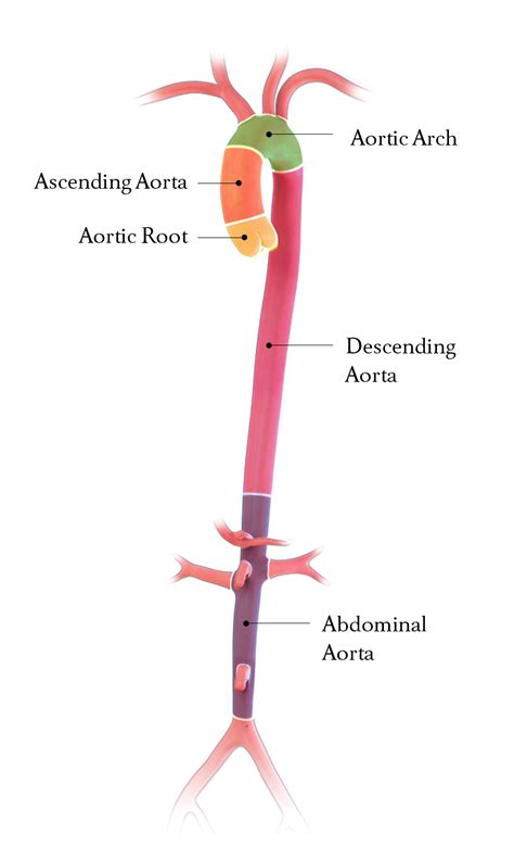 Emory Aortic Center Patient Education