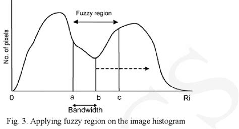 Figure From Histogram Analysis Of The Human Brain Mr Images Based On