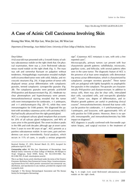 PDF A Case Of Acinic Cell Carcinoma Involving Skin