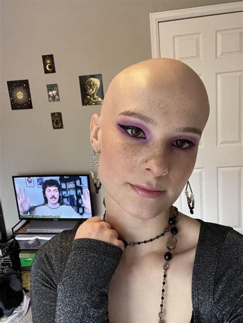 20f Bald Girl With Alopecia I Dont Grow Hair Anywhere R Bald