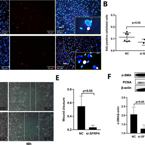 Effect Of Si SFRP4 Nanoparticle Complexes On Dupuytren Disease Cells In