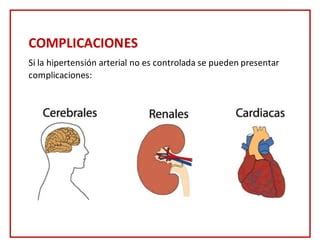 Rotafolio Hipertension Arterial PPT