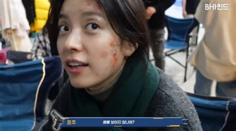 Han Hyo Joo Shows Confidence In Her Wounded Appearance On Set Of