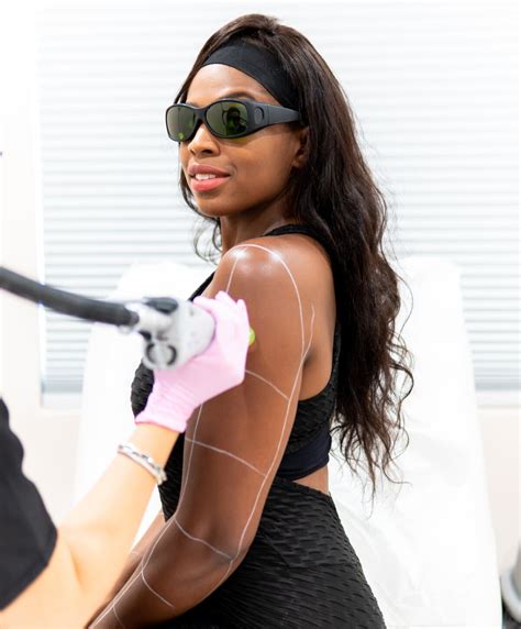 Laser Hair Removal In Los Angeles Sale Online Vivatumusica