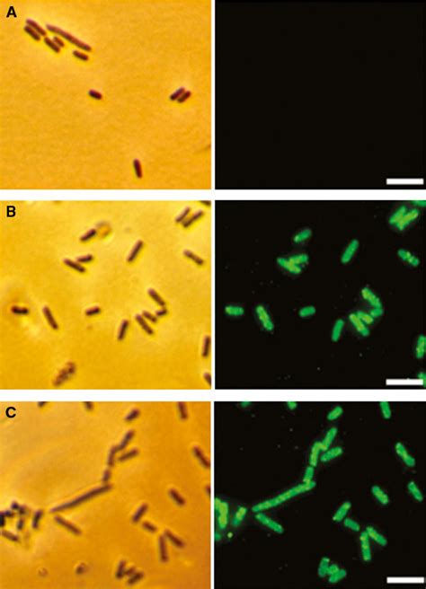 Figure From Surface Display Of Aggregatibacter Actinomycetemcomitans