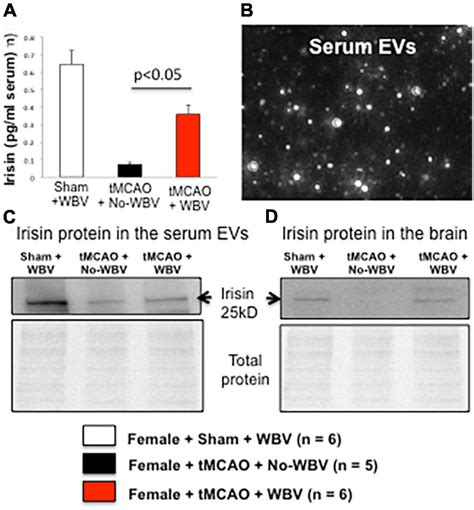 Frontiers Post Stroke Low Frequency Whole Body Vibration Improves