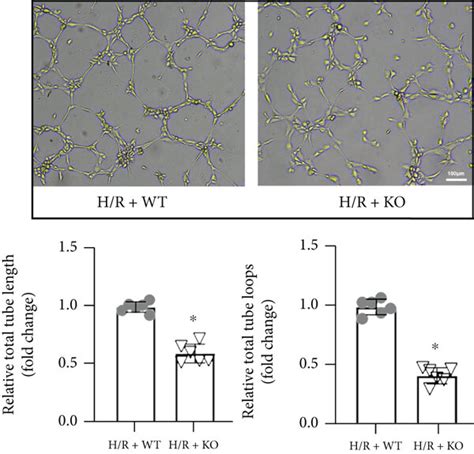 KDM3A Knockout Exaggerated H R Induced CMEC Injury And Dysfunction A