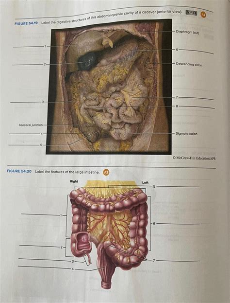 Solved Label The Digestive Structures Of This Abdominopelvic