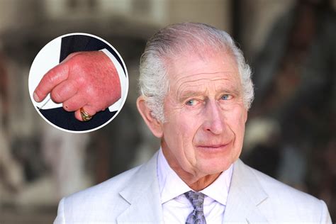 Everything King Charles Said About His Famous Sausage Fingers Newsweek