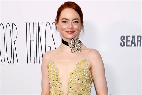 Emma Stone Reveals She Had A Black Eye Before Her 2020 Wedding