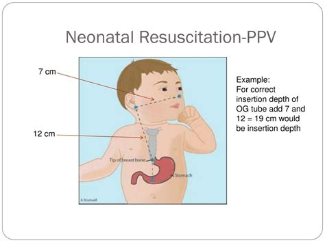 Ppt Neonatal Resuscitation Provider Powerpoint Presentation Free Download Id4502831