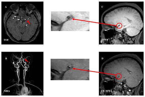 Brain Sciences Free Full Text The Role Of High Resolution Magnetic