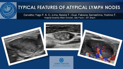 Typical Features of Atypical Lymph Nodes SPR Poster Archive