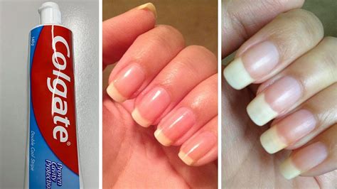 In Just 5 Days Grow Long Strong Nails Fast At Home Super Fast Nails