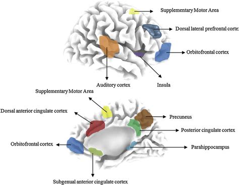 Brain Areas Showing Altered Resting State Eeg Oscillatory Activity In