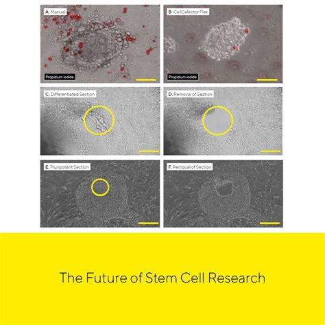 Cellcelector Single Cell Colony Or Organoid Selection And Retrieval