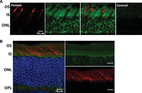 AIPL1 Is Expressed In Adult Cone Photoreceptors A Immunolocalization