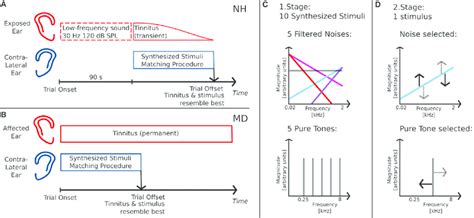 Tinnitus Matching Procedure A Matching Procedure For Download