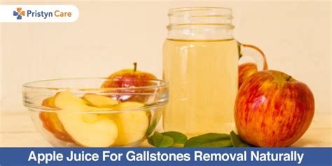 Apple Juice Diet For Gallstones