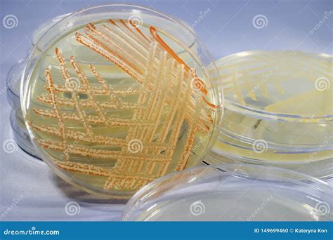 Mixed Culture Of Bacteria Grown On Petri Dish Stock Photo Image Of