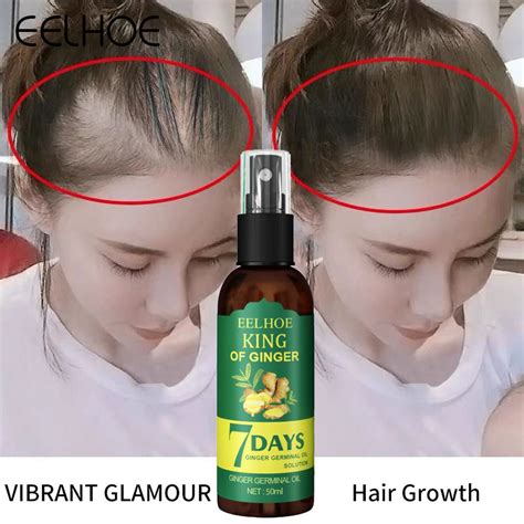 Eelhoe Hair Nutrient Spray Hair Growth Essence Oil Hair Loss Treatment