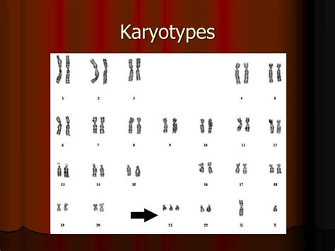 PPT Non Mendelian Patterns Of Inheritance Incomplete Dominance Codominance And Sex Linked