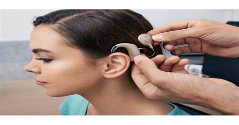 Revolutionizing Hearing The Cochlear Implants Market Takes The World