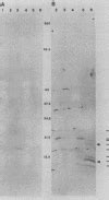 Human Immune Response To Vibrio Cholerae O1 Whole Cells And Isolated