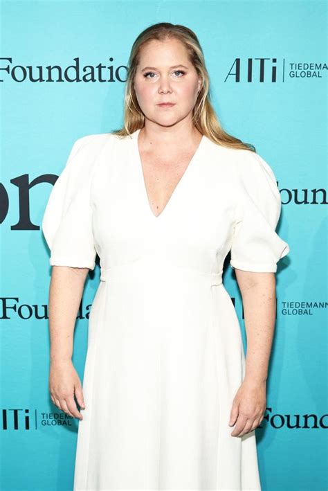 Amy Schumer Says Puffy Face Comments Led To Cushing Syndrome Diagnosis