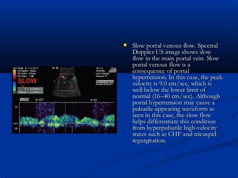 Abnormal Liver Ultrasound