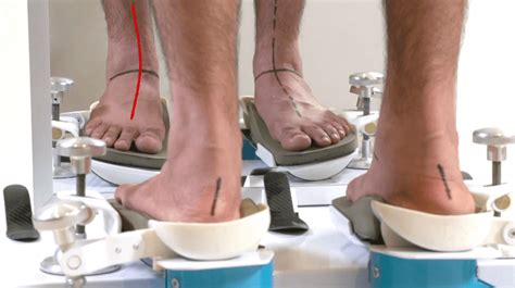 The Foot Alignment Clinic - We fix feet specialising in Custom Orthotics