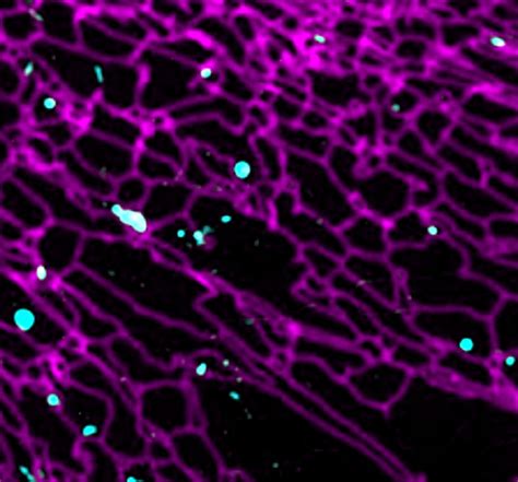 Inter Organelle Communication In Metabolic Control — Welcome To The