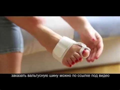 Смотреть Ночной Фиксатор Большого Пальца Стопы Ноги - Ночной Бандаж ...
