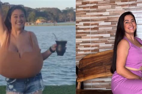 Estudante faz cirurgia e retira 10 kg de mama no Paraná Mais Goiás