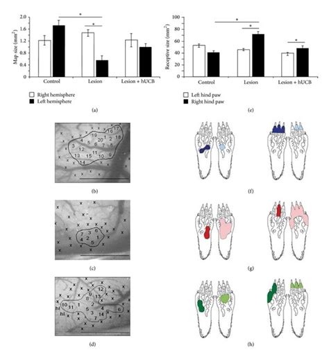 Effects Of Hypoxic Ischemic Brain Injury And Hucb Treatment On