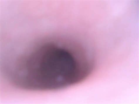 Look Inside Cock Endoscope With Tube Introducing Cam Deep Gay Man Porn Xhamster