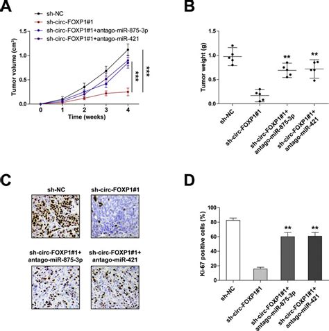 Identification Of The Circ FOXP1 MiR 875 3p MiR 421 Regulatory Axis In