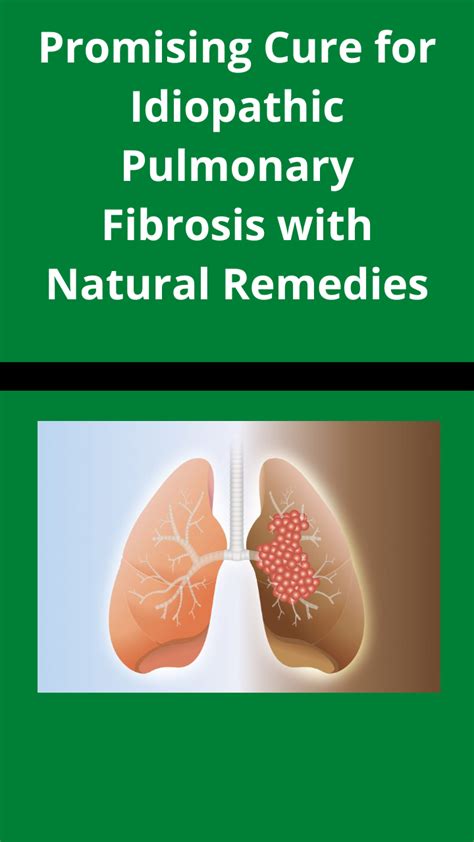 Promising Cure For Idiopathic Pulmonary Fibrosis With Natural Remedies