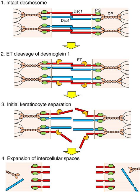 Exfoliative Toxins Of Staphylococcus Aureus Intechopen