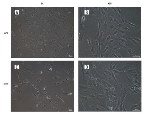 A New Insight Of Kartogenin Induced The Mesenchymal Stem Cells Mscs