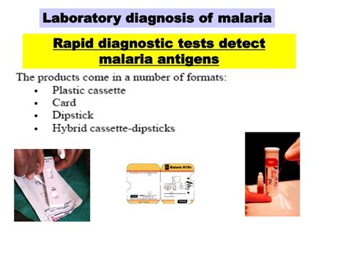 Laboratory Diagnosis Of Malarial Parasite Online Biology Notes