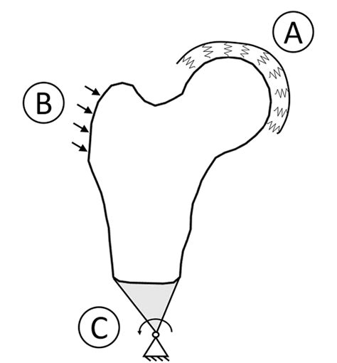 Figure 1 From Improving The Hip Fracture Risk Prediction Through 2d