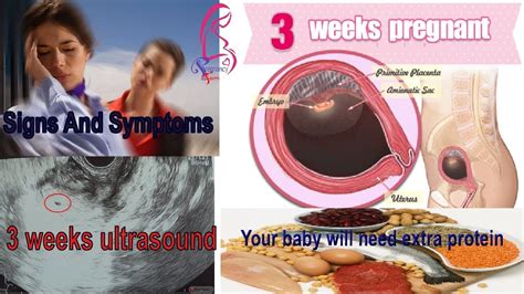 3 Weeks Pregnant And 3 Weeks Pregnant Signs And Symptoms 3 Weeks Ultrasound Pregnancy Term