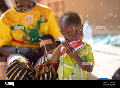 Child Eating The Theraputic Food Plumpynut While In Hospital For