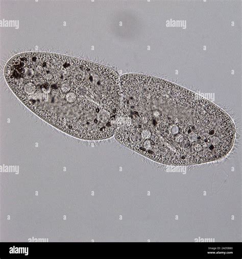 Brightfield Light Micrograph Of Paramecium Paramecium